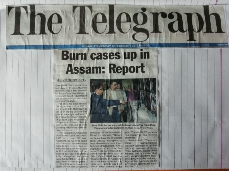 Burn Case up in Assam